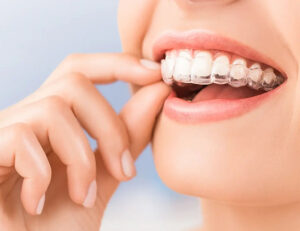 西葛西駅徒歩5分の歯医者、木村歯科医院で歯の真ん中がずれている状態のリスクについての解説