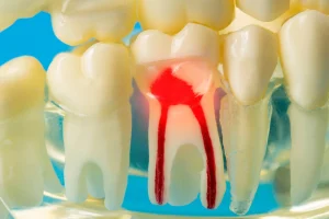 西葛西駅徒歩5分の歯医者、木村歯科医院で、麻酔注射を効きにくくする習慣や行動とは？対処法を解説