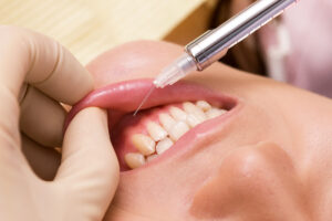 西葛西駅徒歩5分の歯医者、木村歯科医院で、麻酔注射を効きにくくする習慣や行動とは？対処法を解説