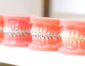 西葛西駅徒歩5分の歯医者、木村歯科医院で、歯ぎしりや食いしばりは自力で治せる？対処法や治療法を解説