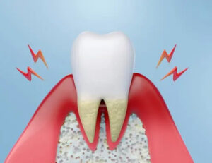 西葛西駅徒歩5分の歯医者、木村歯科医院で、歯ぐきの「特定の1か所だけ」が腫れるのはなぜ？原因や対処法を解説